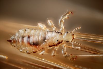 Human Head Lice: What You Need To Know - Massey Services, Inc.